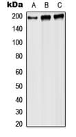 RPA70 / RPA1 Antibody (Internal)