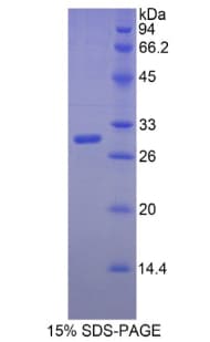 Human MYH3 Protein (Recombinant His)