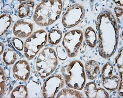 PRKAR2A Antibody (clone OTI4A3)