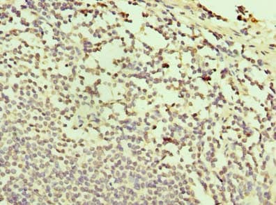 Polyclonal Rabbit anti-Human TXNDC11 Antibody (IHC)