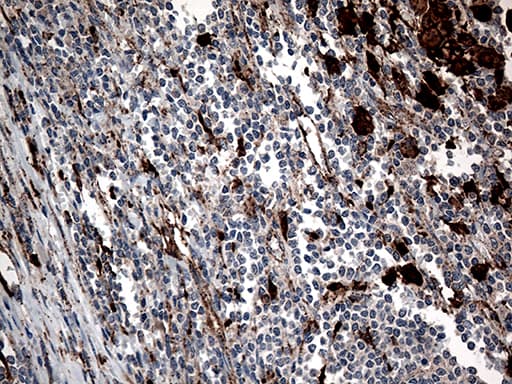 CTSL / Cathepsin L Antibody (aa114-333, clone OTI5A5)