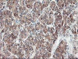 RPN1 / Ribophorin I Antibody (clone OTI2E3)