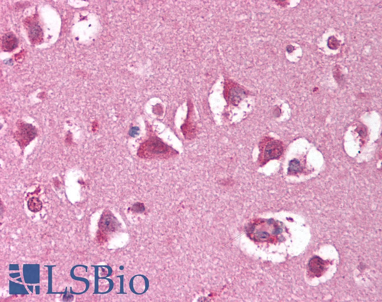 IHC-plus™ Monoclonal Mouse anti-Human XRCC5 / Ku80 Antibody (clone 149.8, C-Terminus, IHC, WB)