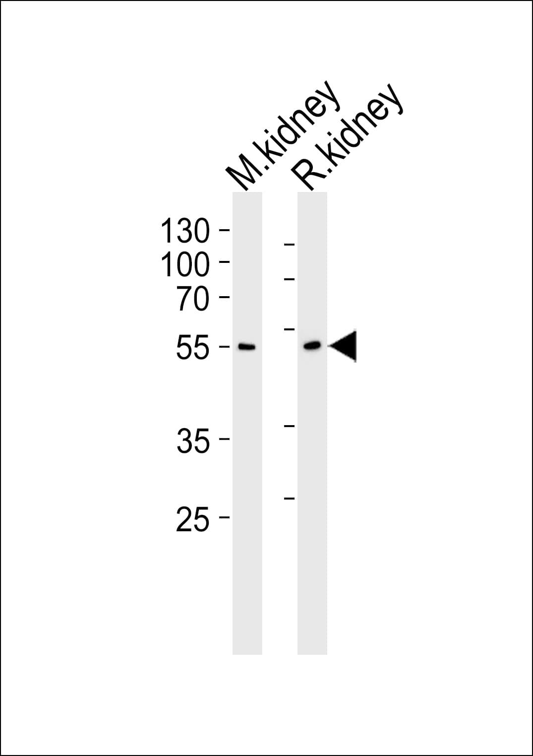 Polyclonal Rabbit anti-Human CNDP1 Antibody (aa128-142, WB)