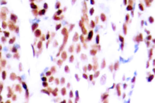 Polyclonal Rabbit anti-Human JUNB / JUN-B Antibody (phospho-Ser79, IHC)