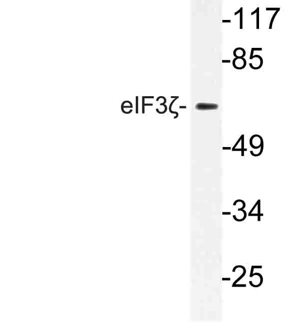 Polyclonal Rabbit anti-Human EIF3D Antibody (Arg135, IHC, WB)