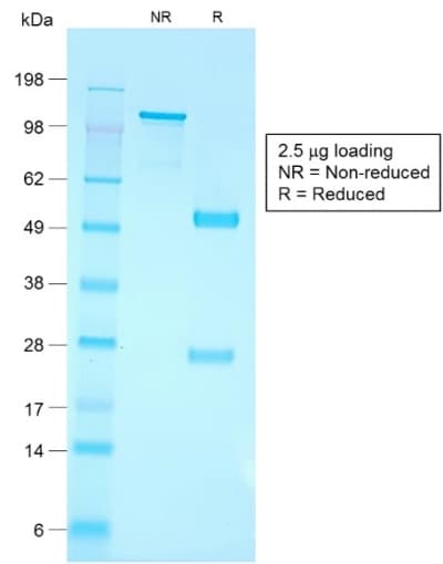 PathPlus™ CD79A / CD79 Alpha Antibody (aa202-216, clone IGA/1790R)