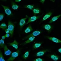 Monoclonal Mouse anti-Human TP53 / p53 Antibody (IHC, IF, WB)