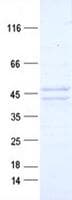Human KRT19 / CK19 / Cytokeratin 19 Protein (Recombinant DDK,C-terminus)