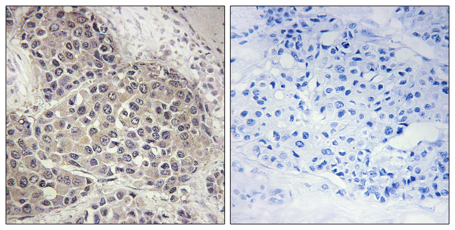 RPS6KB1 / P70S6K / S6K Antibody (phospho-Ser424)