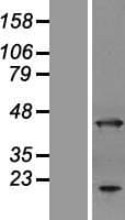 ANKRD2 Protein (Over-Expression Lysate Myc-DDK (Flag))
