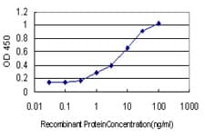 IHC-plus™ Monoclonal Mouse anti-Human HSET / KIFC1 Antibody (clone 2B9, IHC, IF, WB)