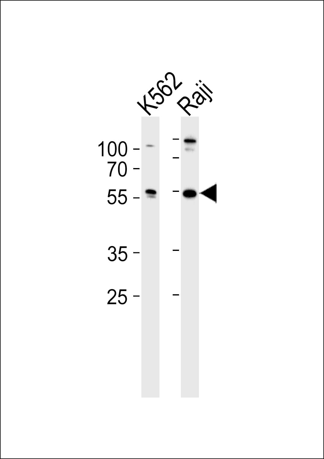 Polyclonal Rabbit anti-Human HCLS1 Antibody (aa362-391, IHC, WB)