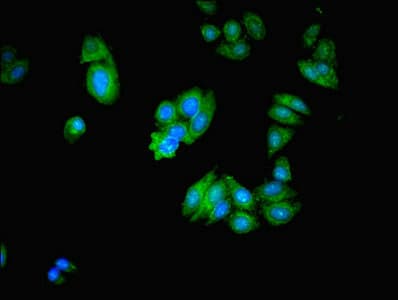 Polyclonal Rabbit anti-Human MICAL2 Antibody
