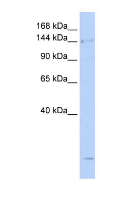 Polyclonal Rabbit anti-Human SMC4 Antibody (aa36-85, WB)