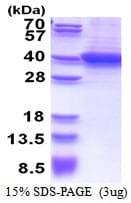 Human RLBP1 / CRALBP Protein (Recombinant His)