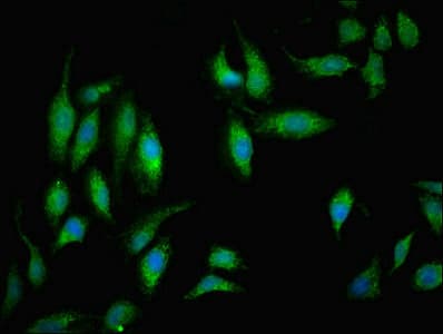 Polyclonal Rabbit anti-Human NDUFB5 Antibody (IHC, IF, WB)