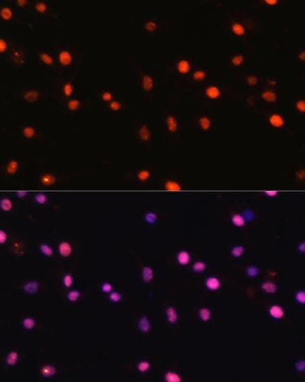 DNMT / DNMT1 Antibody