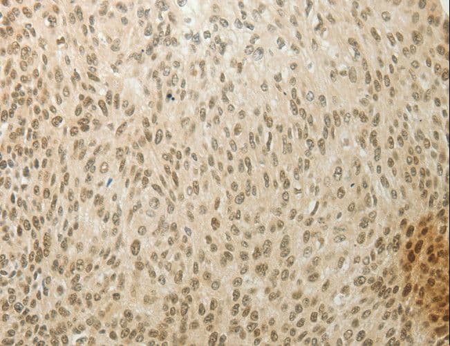 MYSM1 Antibody
