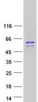 Human SGPL1 Protein (Recombinant Myc-DDK (Flag))