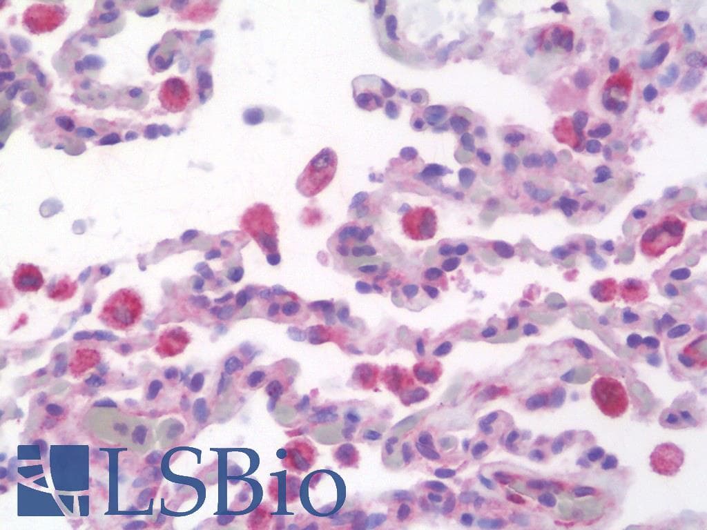 IHC-plus™ RALDH2 / ALDH1A2 Antibody (aa412-461)