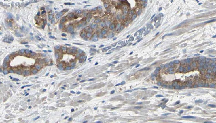 Polyclonal Rabbit anti-Human EIF3S5 / EIF3F Antibody (IHC, IF, WB)