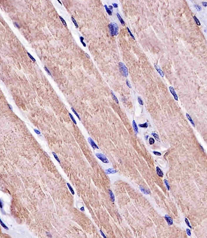 Monoclonal Mouse anti-Human MYO18B / Myosin 18B Antibody (clone 1683CT270.39.50, IHC, WB)