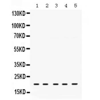 RAP1A Antibody (aa156-181)