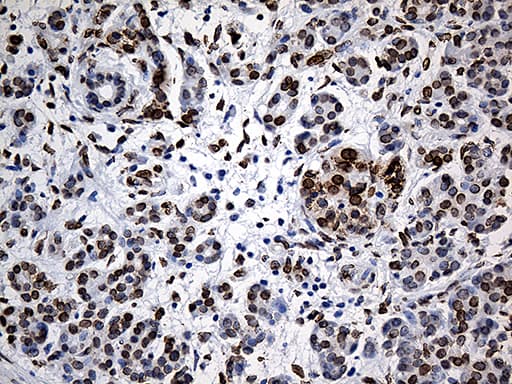 SLU7 / 9G8 Antibody (aa1-300, clone OTI6B1)