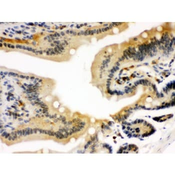 Polyclonal Rabbit anti-Human STAT1 Antibody (aa114-143, IHC, WB)