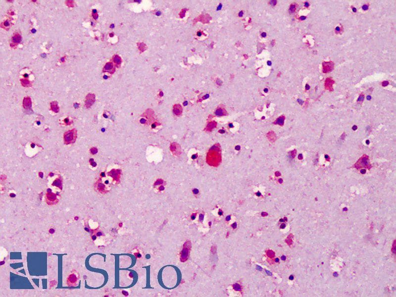 PathPlus™ Monoclonal Mouse anti-Human BRCA1 Antibody (clone 8F7, aa341-748, IHC, WB)