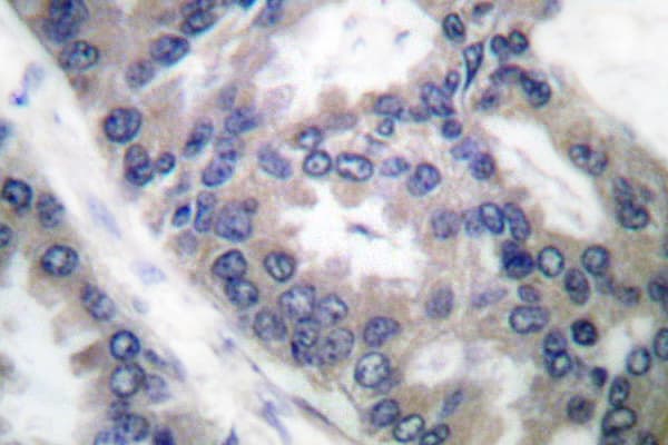 NOS2 / iNOS Antibody (Val1131)