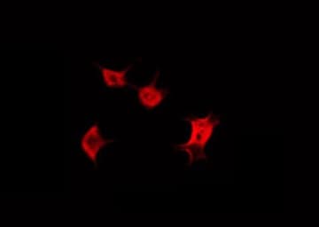 Polyclonal Rabbit anti-Human KRT20 / CK20 / Cytokeratin 20 Antibody (IHC, IF, WB)