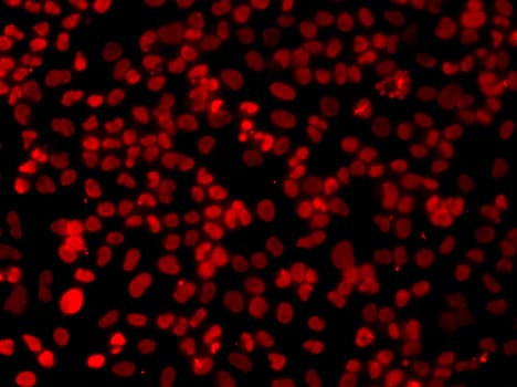 XRCC6 / Ku70 Antibody