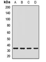 CRYM Antibody