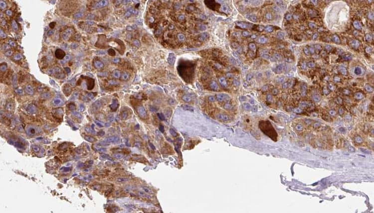 C5AR2 / GPR77 / C5L2 Antibody