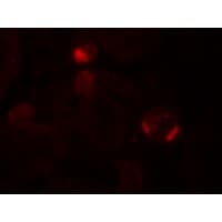 Polyclonal Rabbit anti-Human FAT10 / UBD Antibody (IHC, IF, WB)