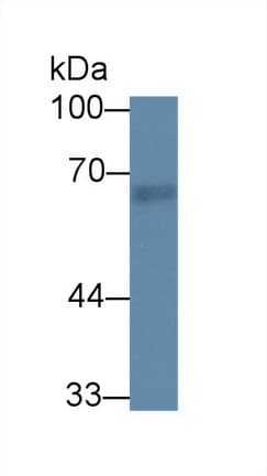RTKN / Rhotekin Antibody (aa296-548)