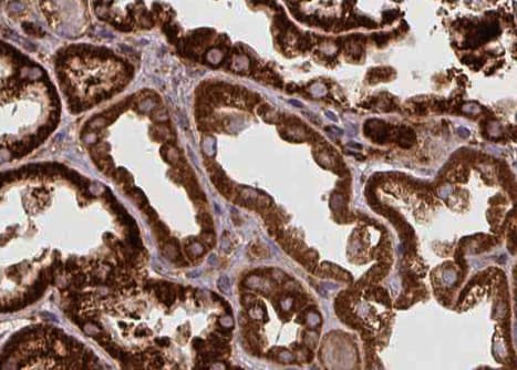 SPHK2 Antibody