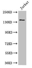 ATXN2 / SCA2 / Ataxin-2 Antibody