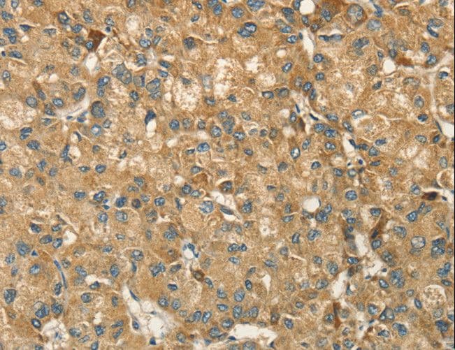 IHC-plus™ HSD17B8 / RING2 Antibody