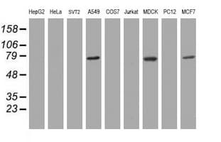 RIPK1 / RIP Antibody (aa133-422, clone 2G3, Carrier-free)