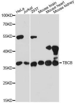 TBCB / CKAP1 Antibody