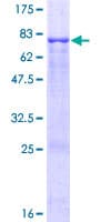 Human PTP1B Protein (Recombinant GST)