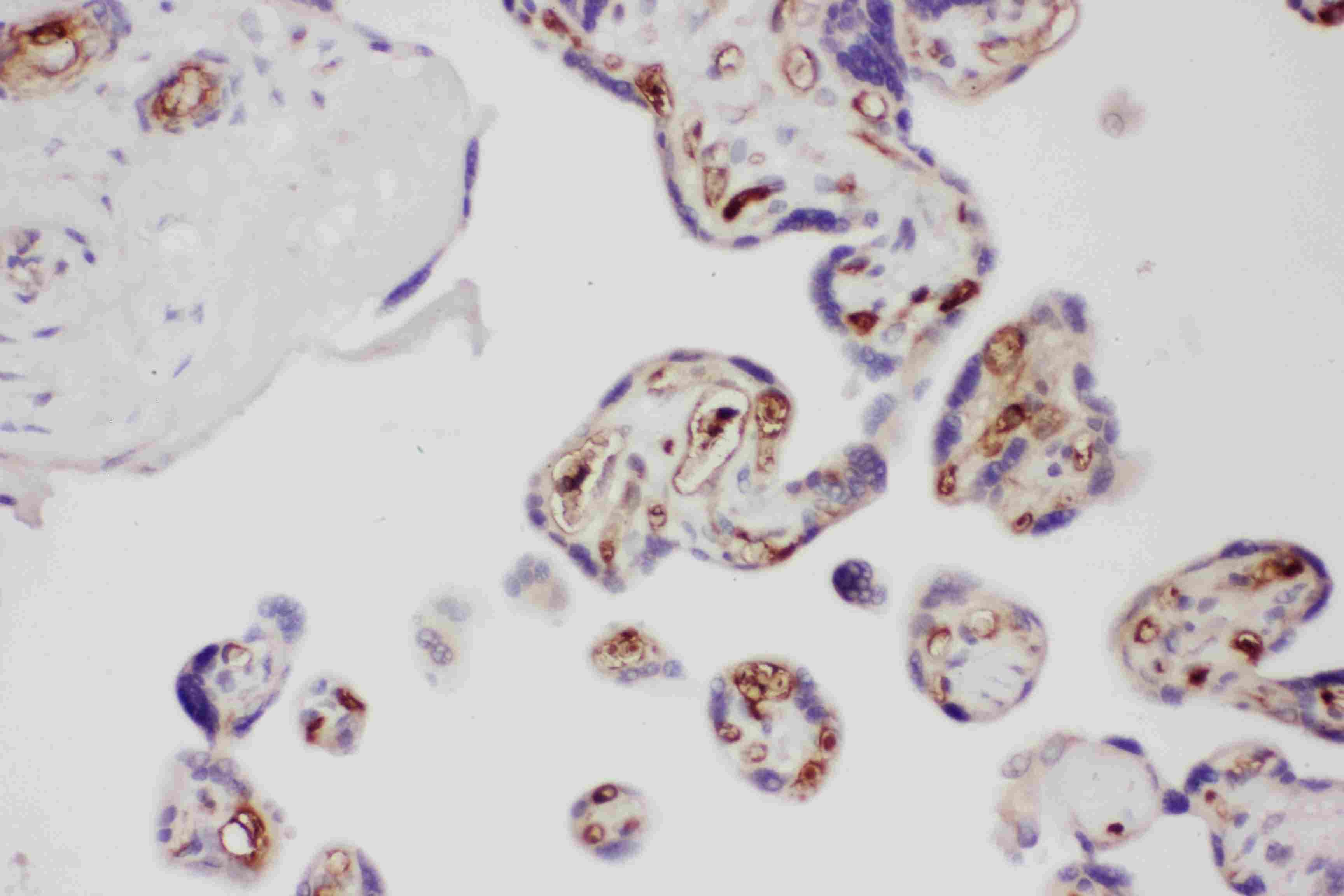 Polyclonal Rabbit anti-Human Adiponectin Antibody (aa19-244, IHC, WB)