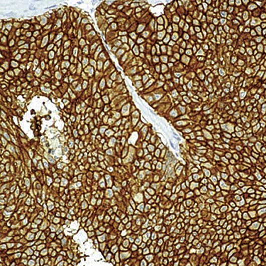 Monoclonal Mouse anti-Human Epithelium Antibody (clone VU-1D9, IHC, WB)