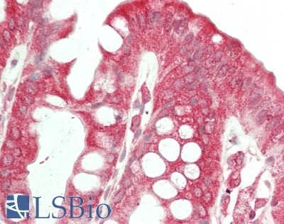 IHC-plus™ GOK / STIM1 Antibody (aa550-600)