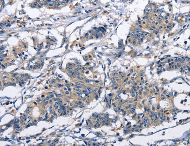 CAPZA2 / CAPZ Alpha 2 Antibody