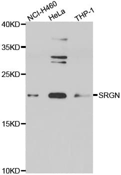 IHC-plus™ Polyclonal Rabbit anti-Human SRGN / Serglycin Antibody (IHC, IF, WB)