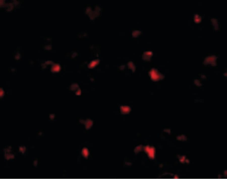 PHAP1 / ANP32A Antibody